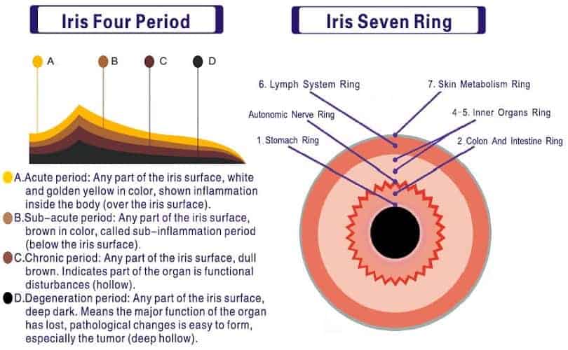 Iris Diagnosis Chart